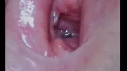 એરોટિકા 6 થી લેબનોન 4 પગથિયાં