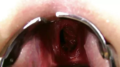 પ્રોલેપ્સ રશિયન